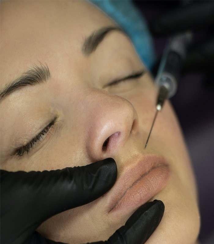 botox Tratamiento con Botox en Clínica Beauté Totale